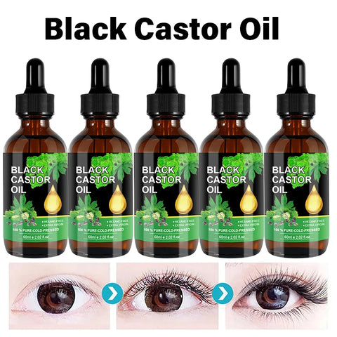 Castor Oil for Hair Growth & Skin Care - Natural Moisturizer & Conditioner