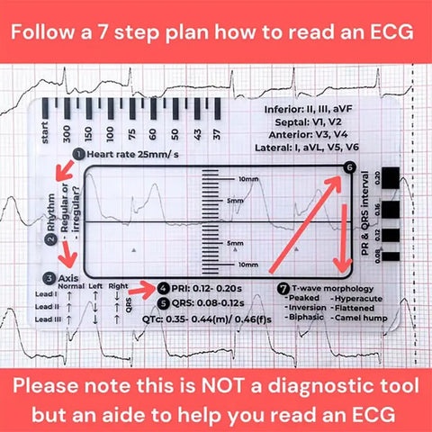 Heart Rate Scale ECG/EKG 7-Step Ruler Orthopedic Joint Transparent Measurement Tool
