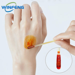 100pcs Disposable Alcohol Swabs & Iodine Cotton Sticks First Aid Kit for Wound Cleaning Antibacterial Care