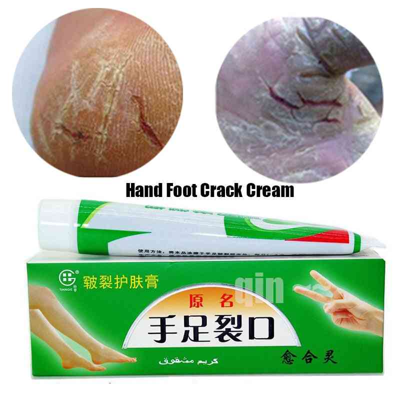Pomada anti-crack esfoliante para as mãos, creme para os pés