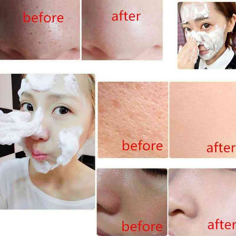 Whitening gezichtszeep diepe reiniging - oliecontrole lifting verstevigende gezichtsreiniging
