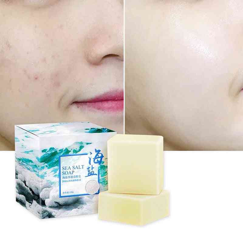 Sea Salt Soap Cleaner , Removal Pimple, Pores Acne Treatment Soap - Goat Milk Moisturizing Skin Face Care Wash