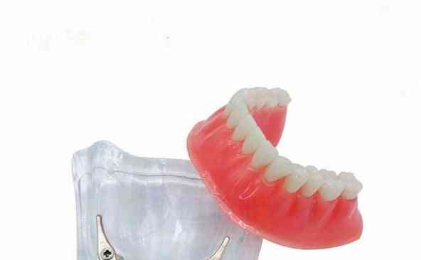 Modèle mandibulaire de dents de prothèse, modèle d'implant overdenture avec modèle d'enseignement dentaire de barre d'or