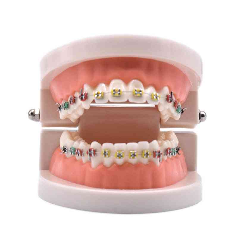 Fogászati ortodontiai kezelési modell orto-fém kerámia konzollal ívhuzal bukkális cső ligatúrák fogászati eszközök