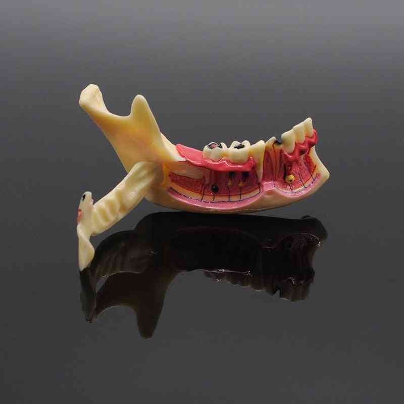 Dentistry Teaching Training Model, Dental Communication Model, Mandibular Model