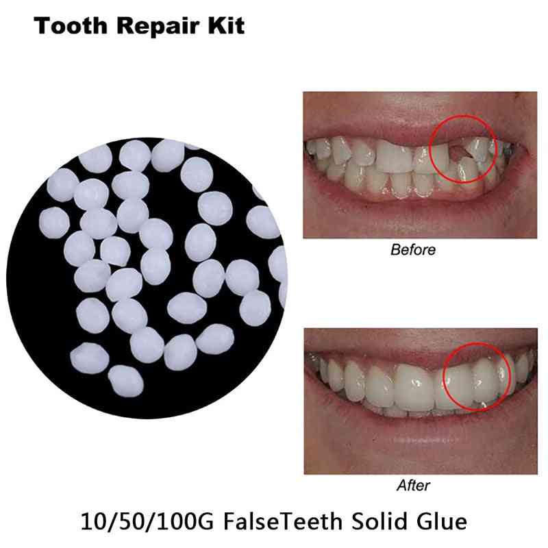 Dinți falși cu lipici solid, set de reparații temporare pentru dinți