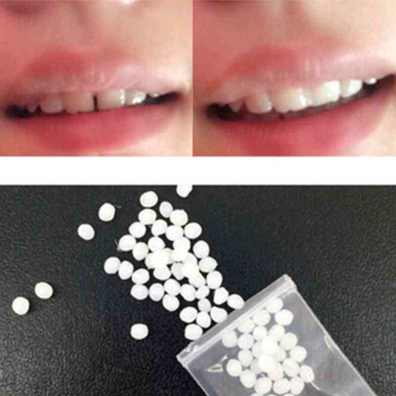 Fasta falsa tänder, tillfällig tandreparationssats