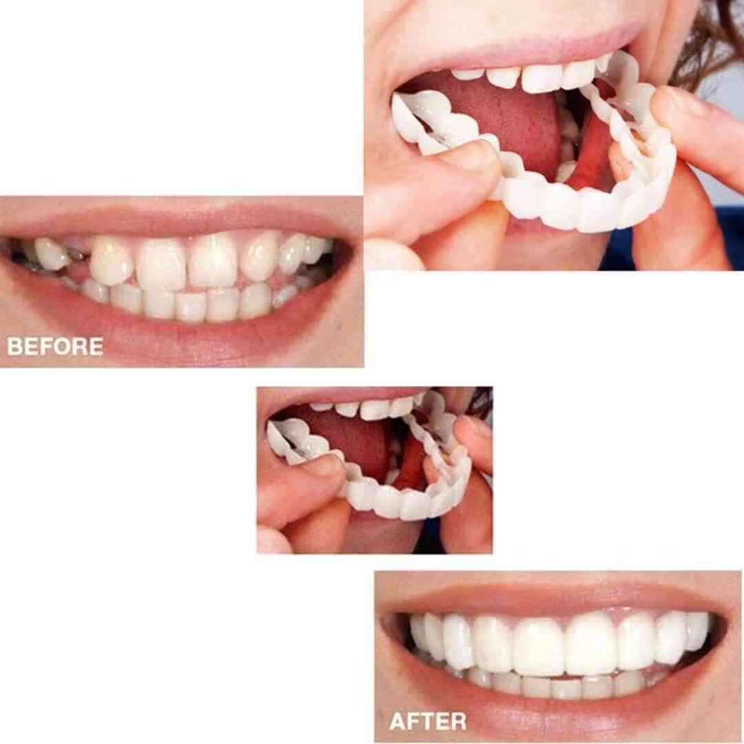 שיניים מלאכותיות עליונות ותחתונות ציפויי חיוך מושלמים נוחות בכושר פלטה להדביק שיניים תותבות לשורה הלבנה כפולה