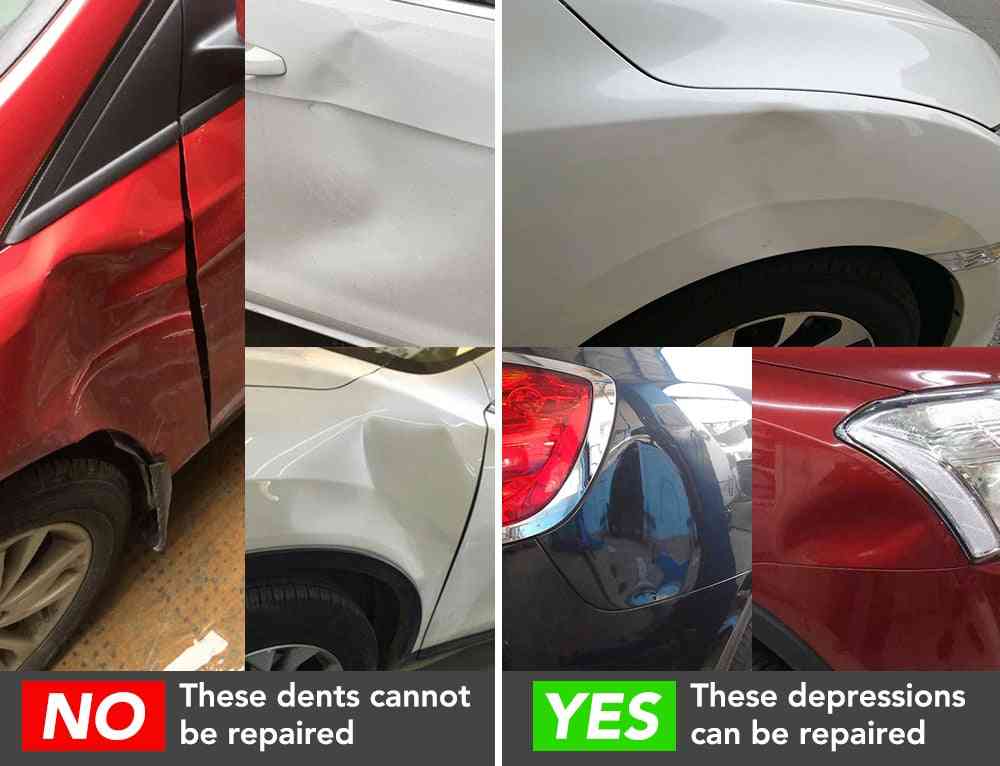 Car Dent Remover Repair Kit For Chevrolet, Cruze, Trax, Aveo Sonic Lova Sail Equinox Captiva Volt Camaro Cobalt Matiz Spark