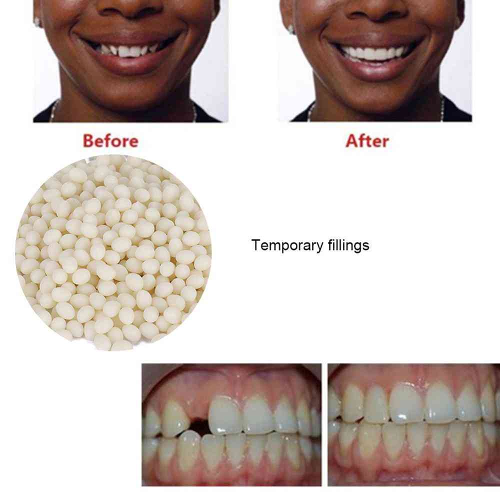 Temporary Tooth Repair, Gaps Filling Denture Adhesive False Teeth Solid Glue