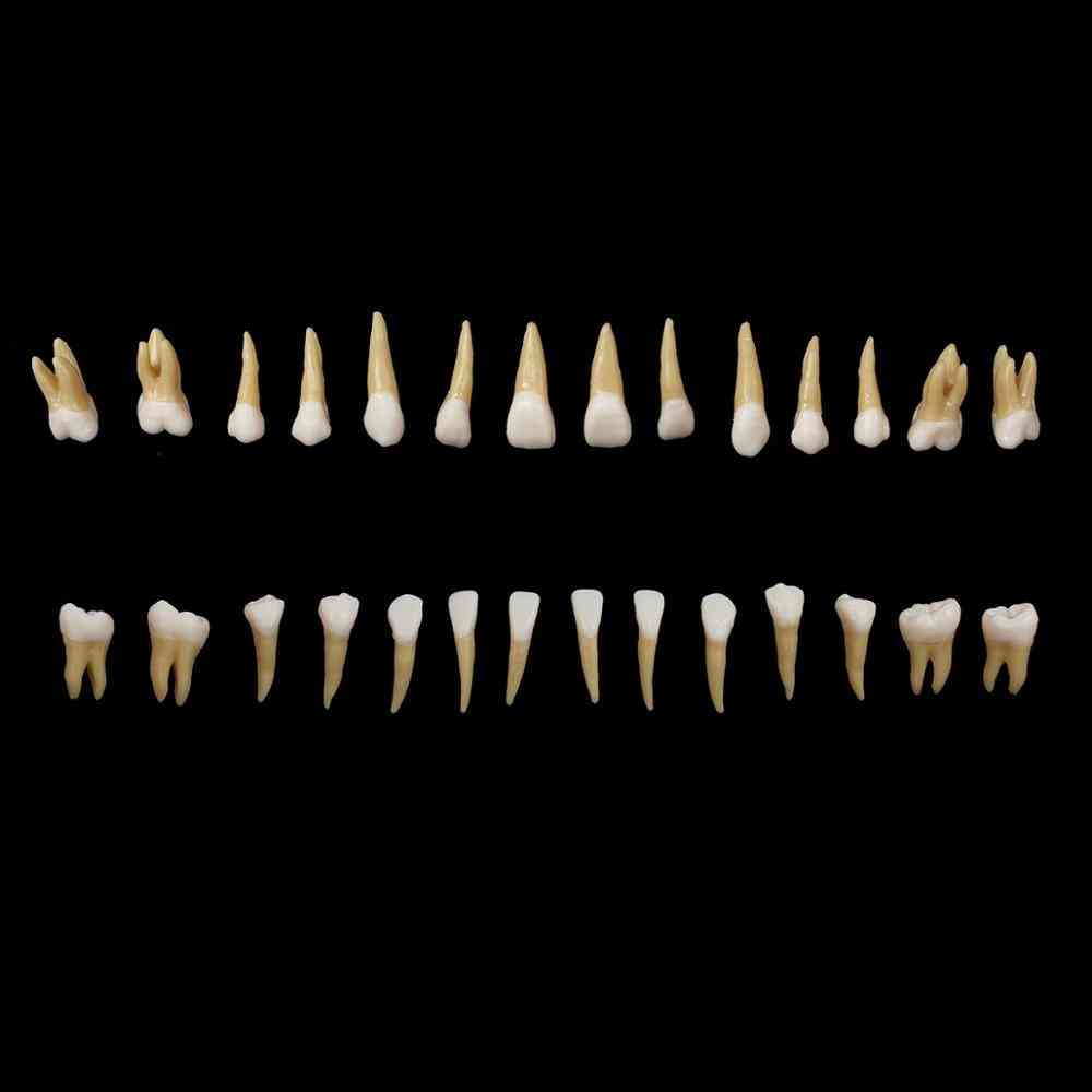 Demostración de dientes permanentes: estudio de enseñanza sobre implantes dentales, modelo de enseñanza.