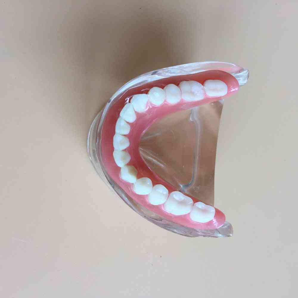 Removable Interior Mandibular Dental Teeth