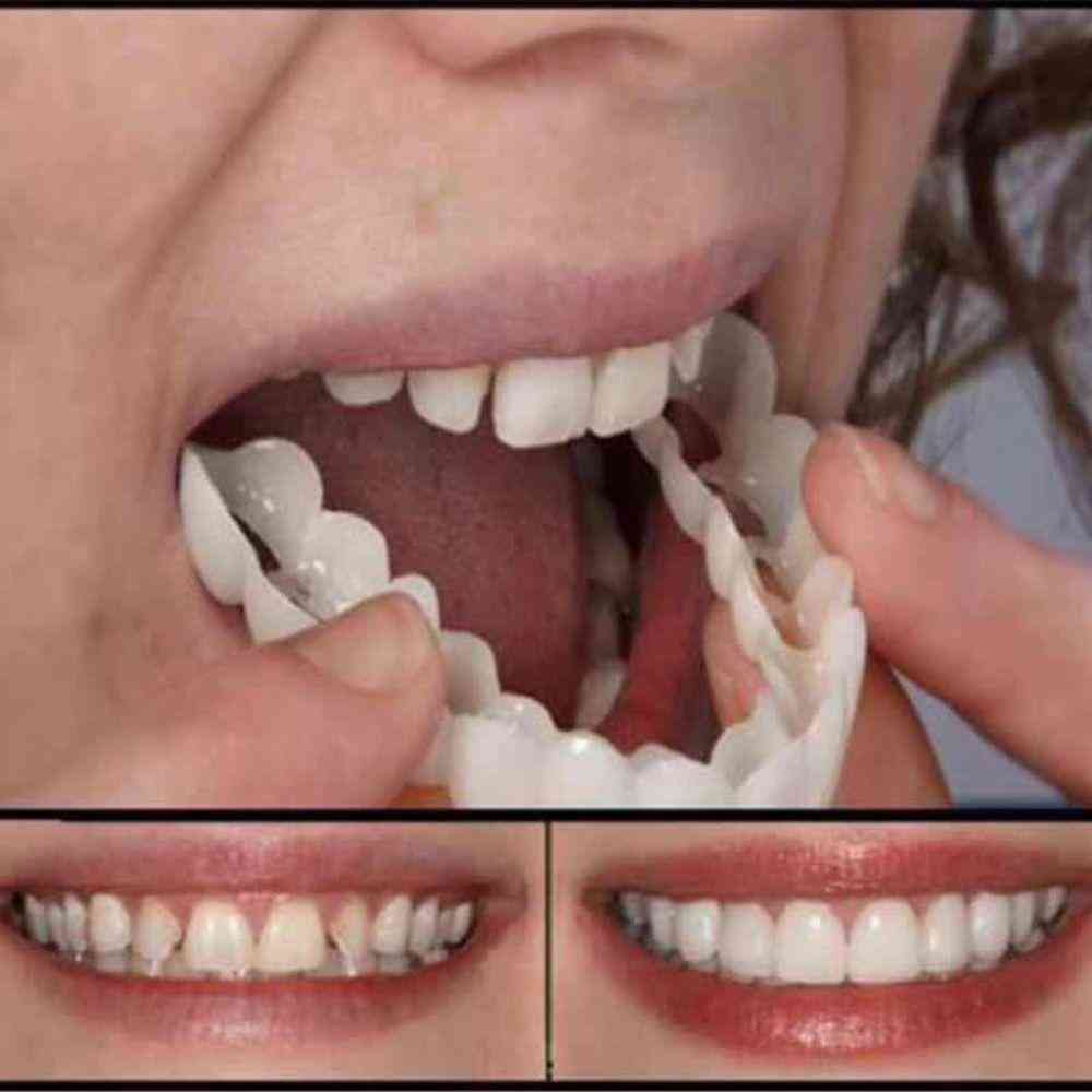 Silikonski ponarejeni zobje, zgornji pokrov lažnih zob