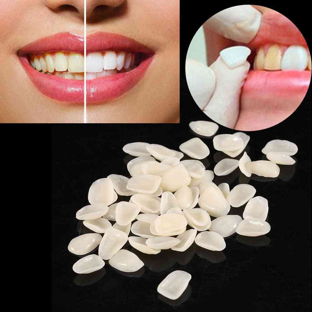1 pack- materiali dentali ultrasottili, faccette in resina composita, denti anteriori superiori