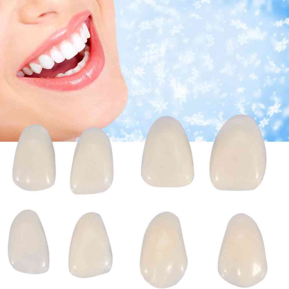 1 paket - ultratanki zobni materiali, kompozitne smolne luske, zgornji sprednji zobje