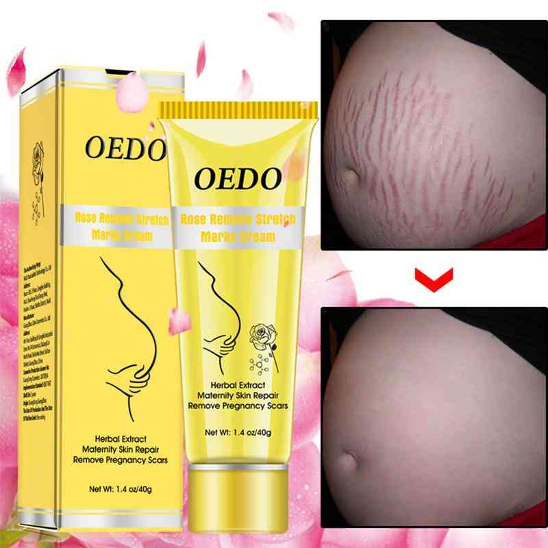 1pc Rose Remove Stretch Marks Cream Anti Wrinkle Anti Aging Maternity Skin Repair Remove Pregnancy Scars Skin Repair Cream Tslm2