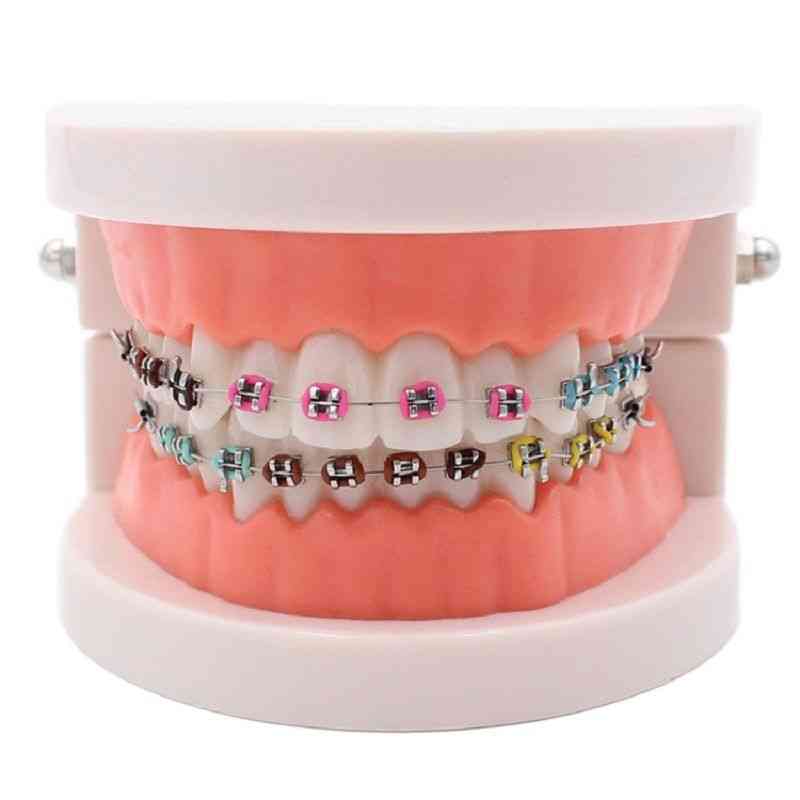 Dental Orthodontic Treatment Teeth Model