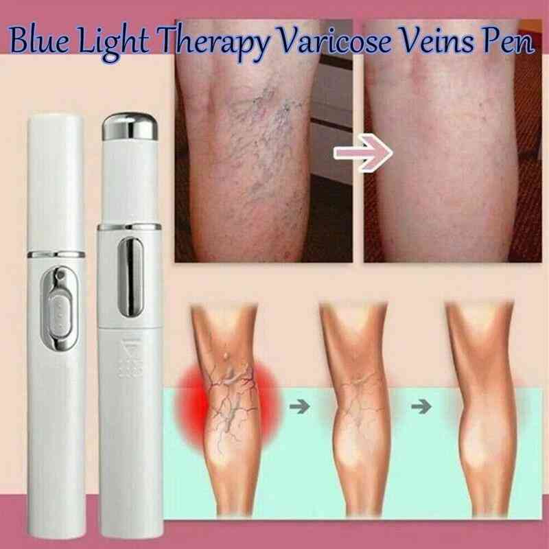 Veins Treatment Medical Blue Light Therapy Pen