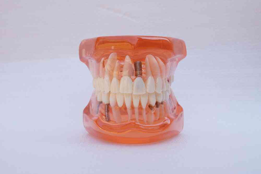 1db fogászati tanítási tanulmány modell standard helyreállítása